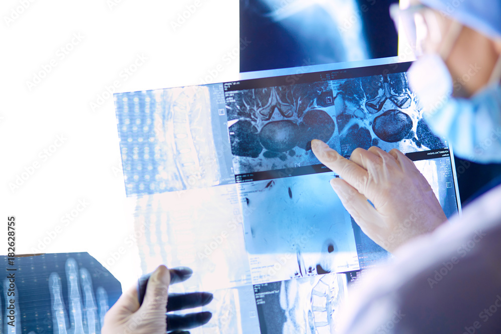 Clinicians reviewing diagnostic imaging to plan colorectal and gastrointestinal surgery